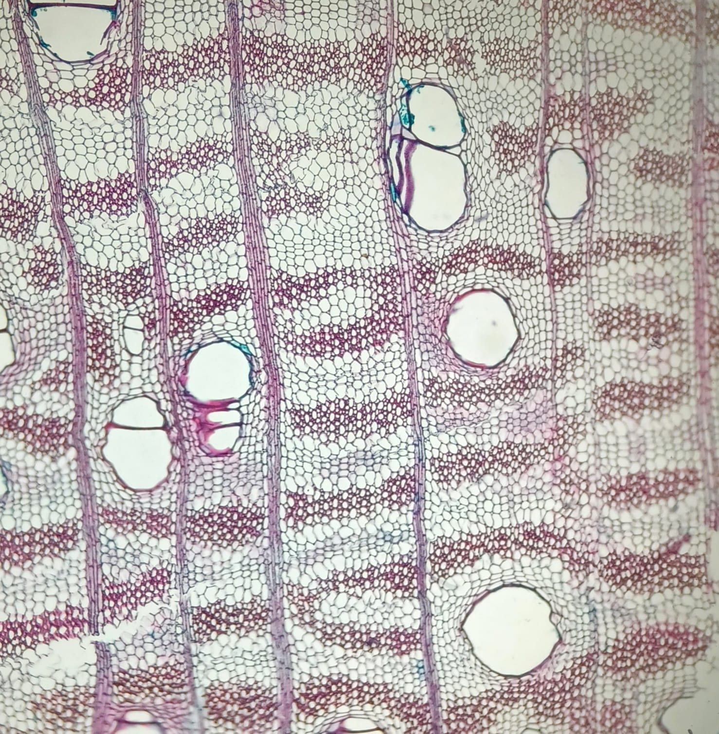 Imagem da anatomia da madeira